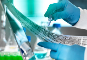 Research scientist holding a sample in a vial with DNA results on autoradiogram gel in laboratory, close up of hand Research scientist holding a sample in a vial with DNA results on autoradiogram gel in laboratory, close up of hand